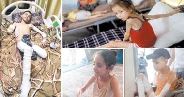 أطفال غزة يموتون جوعا
