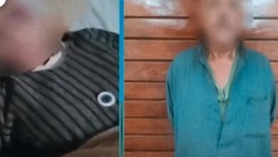 الاب وبنته بعد الإصابة