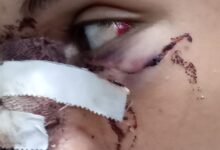 فارس ضحية الغدر