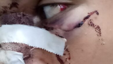 فارس ضحية الغدر