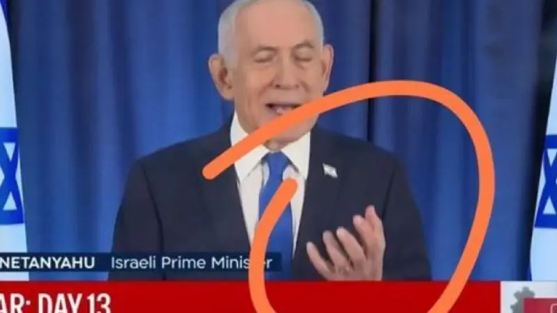 ظهور بنيامين نتنياهو بستة اصابع